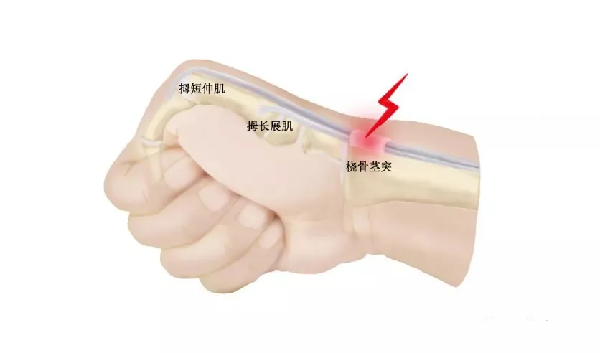 2.png 2.png
