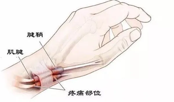 3.png 3.png