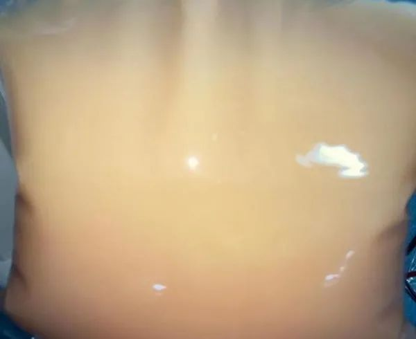 1.png 1.png