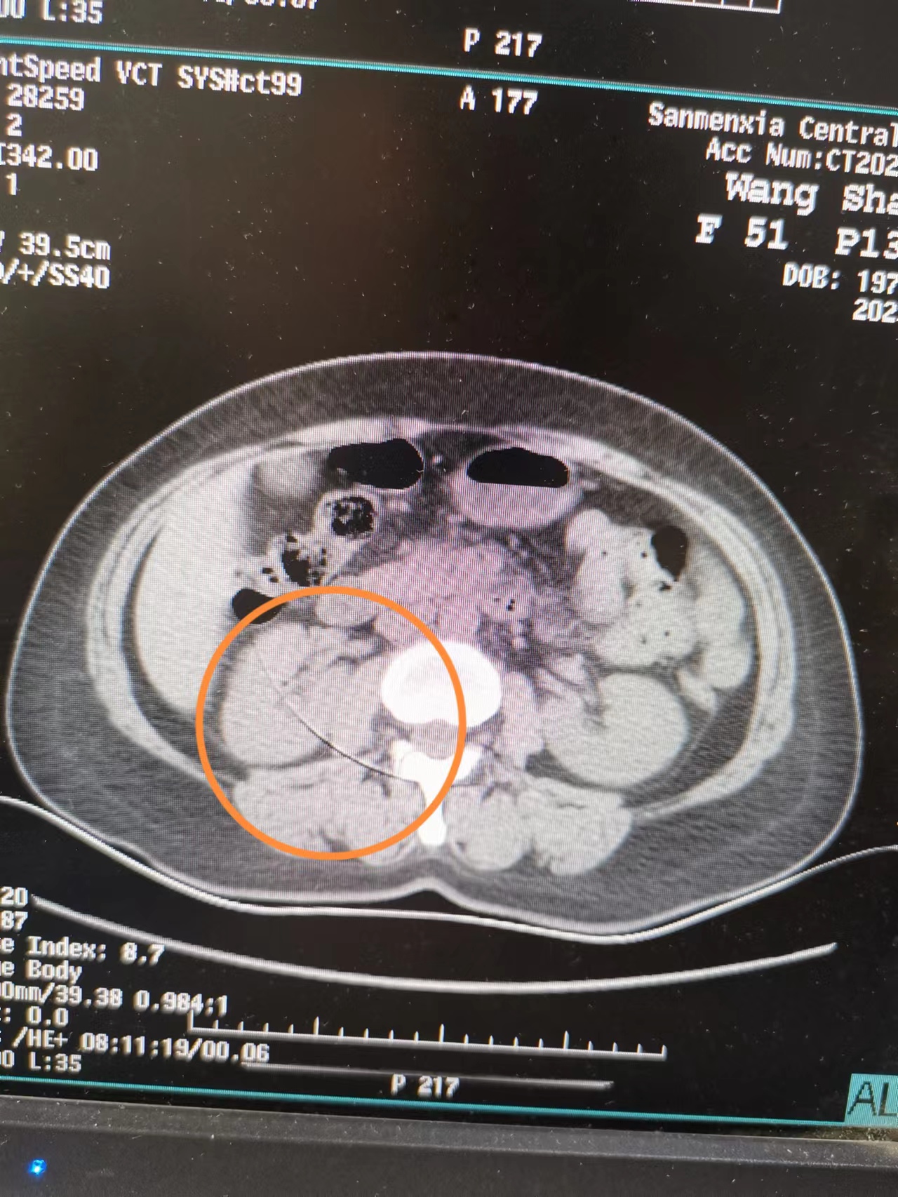 a01d34231bb39ea7ba98e1adcc8d3eb.jpg a01d34231bb39ea7ba98e1adcc8d3eb.jpg