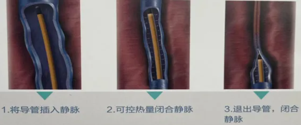 QQ浏览器截图20241024162507.png