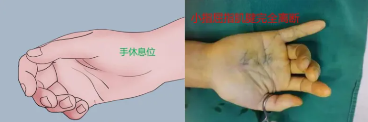 QQ浏览器截图20250224095643.png