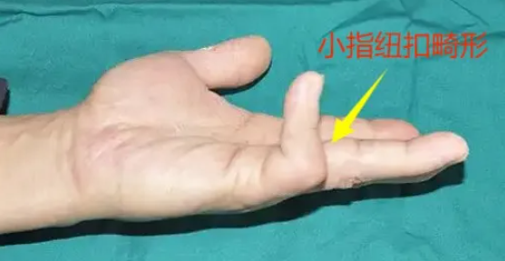 QQ浏览器截图20250224095658.png