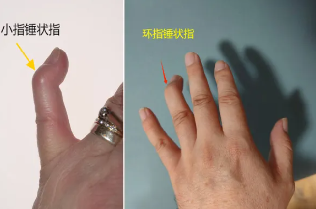 QQ浏览器截图20250224095652.png