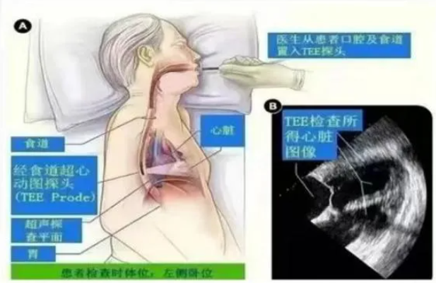 QQ浏览器截图20250908114834.png